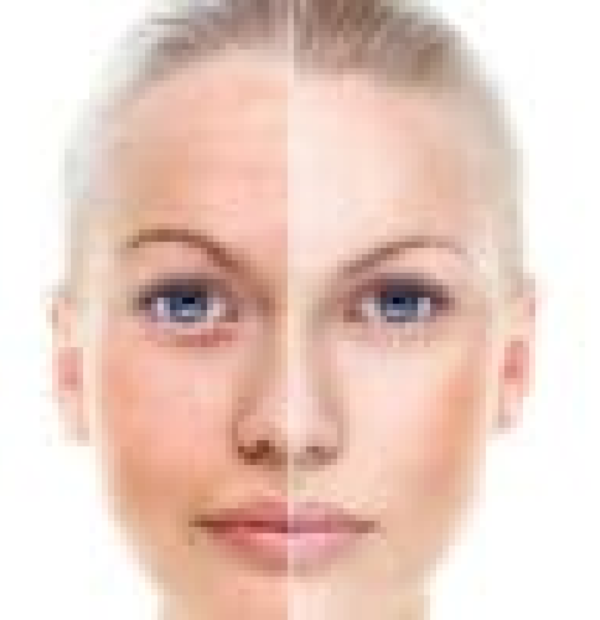 Dermacell Microdermabrasion (Refurbished) - Image 3